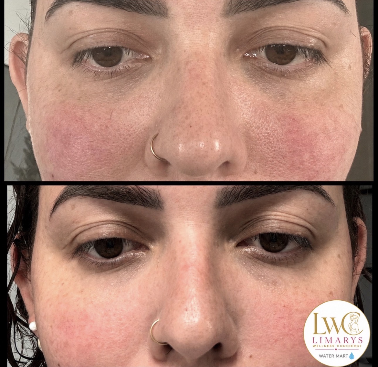 Client Progress — Limarys Wellness Concierge